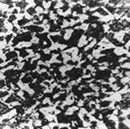 Microestructura de acero al carbono, cristales blancos de ferrita Microestructura de acero al carbono, cristales blancos de ferrita